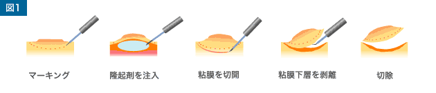 図1 図1