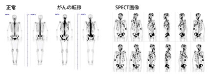 核医学検査とは？