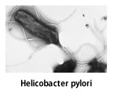 ピロリ菌抗体検査